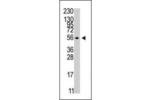 The STK38 polyclonal antibody  is used in Western blot to detect STK38 in Jurkat cell line lysates . (STK38 Antikörper  (C-Term))