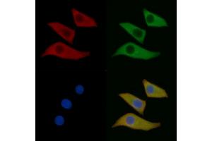 OPRM1 Mouse Monoclonal Antibody staining Hela cells by IF/ICC. (Mu Opioid Receptor 1 Antikörper  (C-Term))