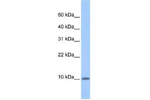WB Suggested Anti-C20orf141 Antibody Titration: 0.