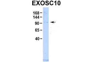 Host:  Rabbit  Target Name:  EXOSC10  Sample Type:  Human 293T  Antibody Dilution:  1. (EXOSC10 Antikörper  (C-Term))