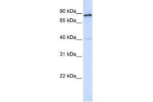 WB Suggested Anti-DNM1 Antibody Titration: 0. (Dynamin 1 Antikörper  (Middle Region))