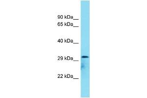 Host: Rabbit Target Name: C8orf74 Sample Type: COLO205 Whole Cell lysates Antibody Dilution: 1. (C8ORF74 Antikörper  (C-Term))