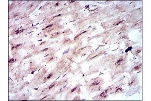 Immunohistochemical analysis of paraffin-embedded cardiac muscle tissues using SLC2A4 mouse mAb with DAB staining. (GLUT4 Antikörper  (AA 224-353))