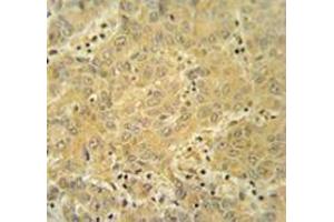 Immunohistochemistry (Paraffin-embedded Sections) (IHC (p)) image for anti-Cytochrome P450, Family 2, Subfamily A, Polypeptide 7 (CYP2A7) (AA 128-15), (Middle Region) antibody (ABIN951781)