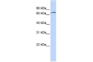WB Suggested Anti-ZNF768 Antibody Titration: 0. (ZNF768 Antikörper  (N-Term))