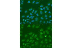 Immunofluorescence analysis of A549 cells using ORC6 antibody.