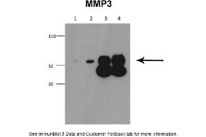 Sample Type: 1. (MMP3 Antikörper  (Middle Region))