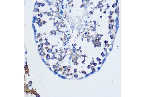Immunohistochemistry (IHC) image for anti-Trans-Golgi Network Protein 2 (TGOLN2) antibody (ABIN7270876)
