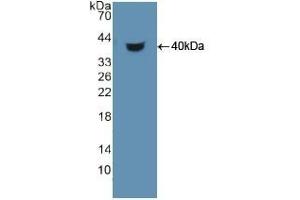 Detection of Recombinant HDGF, Human using Polyclonal Antibody to Hepatoma Derived Growth Factor (HDGF) (HDGF Antikörper  (AA 10-240))