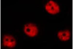 ABIN6267315 staining MOLT by IF/ICC. (Retinoblastoma 1 Antikörper  (pSer780))