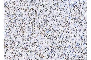 IHC analysis of HnRNP H/HNRNPH1 using anti-HnRNP H/HNRNPH1 antibody (ABIN4886623).
