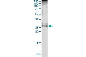 Immunoprecipitation (IP) image for anti-Defective in Cullin Neddylation 1, Domain Containing 1 (DCUN1D1) (AA 1-259) antibody (ABIN527032)