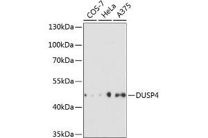 Western blot analysis of extracts of various cell lines, using DUSP4 antibody (ABIN3016539, ABIN3016540, ABIN3016541 and ABIN6219776) at 1:3000 dilution. (DUSP4 Antikörper  (AA 1-168))