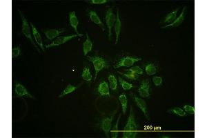 Immunofluorescence of monoclonal antibody to HTRA2 on HeLa cell. (HTRA2 Antikörper  (AA 359-458))