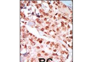 Immunohistochemistry (IHC) image for anti-Protein Kinase, AMP-Activated, gamma 3 Non-Catalytic Subunit (PRKAG3) (AA 265-295) antibody (ABIN5533705)