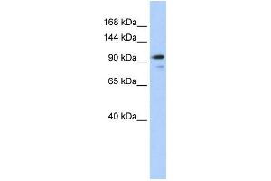 Human 293T; WB Suggested Anti-AMOTL1 Antibody Titration: 0. (AMOTL1 Antikörper  (N-Term))