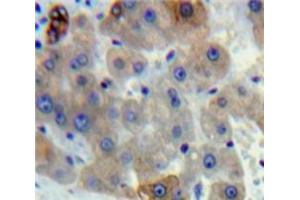 Used in DAB staining on fromalin fixed paraffin-embedded Liver tissue (gamma Lipotropin (AA 179-234) Antikörper)