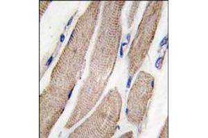Image no. 1 for anti-Mitogen-Activated Protein Kinase Kinase 5 (MAP2K5) (Ser149) antibody (ABIN360284) (MAP2K5 Antikörper  (Ser149))