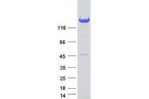 Western Blotting (WB) image for Phosphatidylinositol Transfer Protein, Membrane-Associated 2 (PITPNM2) protein (Myc-DYKDDDDK Tag) (ABIN2729024)