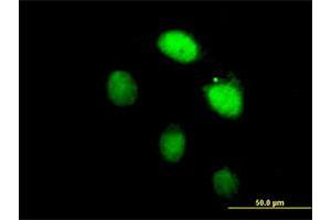 Immunofluorescence of purified MaxPab antibody to LHX4 on HeLa cell.