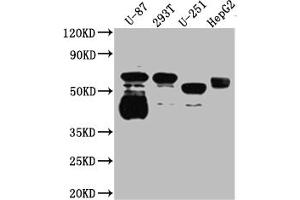 Western Blot Positive WB detected in: U-87 whole cell lysate, 293T whole cell lysate, U-251 whole cell lysate, HepG2 whole cell lysate All lanes: Serotonin transporter antibody at 1:1000 Secondary Goat polyclonal to rabbit IgG at 1/50000 dilution Predicted band size: 71, 75 kDa Observed band size: 55 kDa (Rekombinanter SLC6A4 Antikörper)