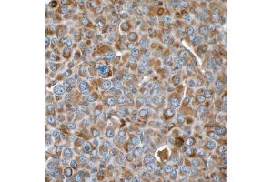 Immunohistochemistry (IHC) image for anti-Vimentin (VIM) (AA 325-375) antibody (ABIN7449539) (Rekombinanter Vimentin Antikörper  (AA 325-375))