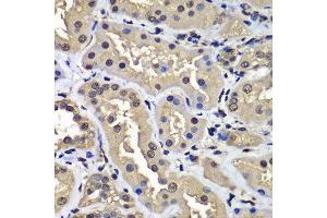 Immunohistochemistry of paraffin-embedded human kidney using CCAR2 antibody at dilution of 1:100 (x400 lens). (CCAR2 Antikörper)