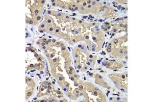 Immunohistochemistry of paraffin-embedded human kidney using CCAR2 antibody at dilution of 1:100 (x400 lens).