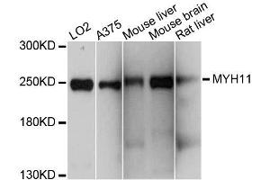 Western blot analysis of extracts of various cell lines, using MYH11 antibody. (MYH11 Antikörper  (AA 1680-1979))