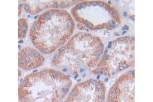 Used in DAB staining on fromalin fixed paraffin- embedded Kidney tissue (CCL14 Antikörper  (AA 20-93))