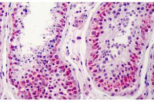Human Testis: Formalin-Fixed, Paraffin-Embedded (FFPE) (NEK2 Antikörper  (AA 287-299))