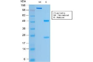 SDS-PAGE (SDS) image for anti-Cystic Fibrosis Transmembrane Conductance Regulator (ATP-Binding Cassette Sub-Family C, Member 7) (CFTR) antibody (ABIN6939094)