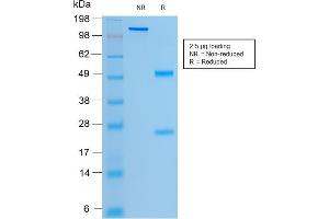 SDS-PAGE Analysis Purified CFTR Mouse Recombinant Monoclonal Antibody (rCFTR/1342).