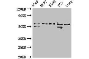 Western Blot Positive WB detected in: A549 whole cell lysate, MCF-7 whole cell lysate, K562 whole cell lysate, PC-3 whole cell lysate, Rat lung tissue All lanes: SERPING1 antibody at 2 μg/mL Secondary Goat polyclonal to rabbit IgG at 1/50000 dilution Predicted band size: 56, 50 kDa Observed band size: 56 kDa (SERPING1 Antikörper  (AA 23-300))