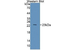 Western blot analysis of the recombinant protein. (ABCA9 Antikörper  (AA 1416-1583))