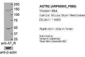 Western Blotting (WB) image for anti-Angiotensin II Receptor, Type 2 (AGTR2) (N-Term) antibody (ABIN2788290) (Angiotensin II Type 2 Receptor Antikörper  (N-Term))