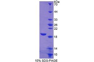 SDS-PAGE analysis of Human SIGLEC7 Protein. (SIGLEC7 Protein)