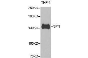 Western blot analysis of extracts of THP-1 cells, using SPN antibody.