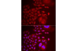 Immunofluorescence analysis of U2OS cells using TRAPPC10 antibody (ABIN5974105).