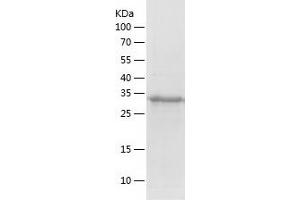 Western Blotting (WB) image for V-Crk Sarcoma Virus CT10 Oncogene Homolog (Avian)-Like (CRKL) (AA 1-303) protein (His-IF2DI Tag) (ABIN7125677)
