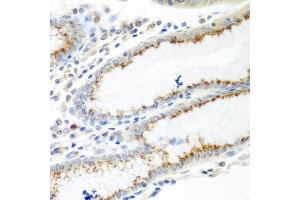 Immunohistochemistry of paraffin-embedded human stomach using UBI antibody (ABIN6134946, ABIN6149845, ABIN6149848 and ABIN6223555) at dilution of 1:100 (40x lens). (UBIAD1 Antikörper  (AA 1-100))