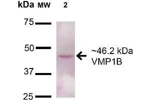Western blot analysis of Rat Pancreas cell lysates showing detection of 46. (VMP1 Antikörper  (AA 391-402) (Atto 390))