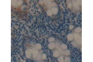 Used in DAB staining on fromalin fixed paraffin- embedded rectum tissue (PA2G4 Antikörper  (AA 2-394))