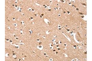 The image on the left is immunohistochemistry of paraffin-embedded Human brain tissue using ABIN7190421(CYP46A1 Antibody) at dilution 1/15, on the right is treated with synthetic peptide. (CYP46A1 Antikörper)