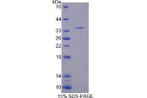 Image no. 1 for Tropomyosin 3 (TPM3) (AA 6-248) protein (His tag) (ABIN6237908)