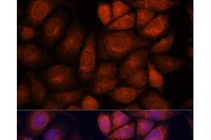 Immunofluorescence analysis of HeLa cells using KIF13A Polyclonal Antibody at dilution of 1:100.