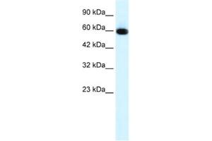 Western Blotting (WB) image for anti-GLIS Family Zinc Finger 2 (GLIS2) antibody (ABIN2460154) (GLIS2 Antikörper)