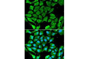 Immunofluorescence analysis of A549 cell using PPARG antibody. (PPARG Antikörper  (AA 50-150))
