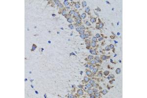 Immunohistochemistry of paraffin-embedded rat brain using PTPN1 antibody. (PTPN1 Antikörper)