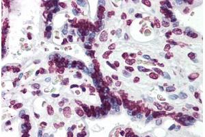 Human Placenta: Formalin-Fixed, Paraffin-Embedded (FFPE) (Aryl Hydrocarbon Receptor Antikörper  (AA 279-376))